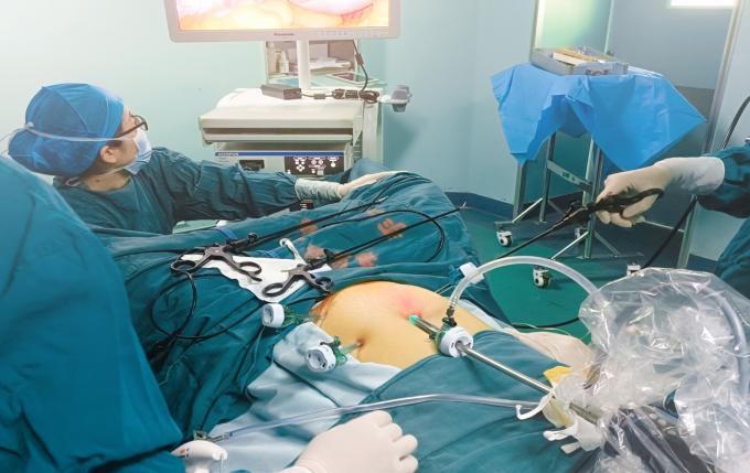 Kit de Trocar Disponível Laparoscópico Trocares Cirúrgicos Médicos para Cirurgia Laparoscópica 7