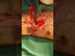 Medical Instrument Pets Surgery Ultrasonic Scalpel Class II Veterinary Ultrasonic Scalpel