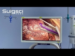 Aplicação clínica do Surgsci Endo Cutter Stapler na cirurgia